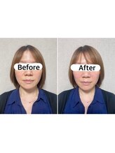 キュープ 浜松店(Qpu)/初回から変化あり♪