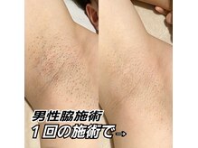 チェリー(Cherry)の雰囲気（脱毛は、朝10時から夜9時まで営業中！）