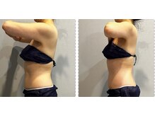 ラヴィエール(Laviere)/レディース痩身120分