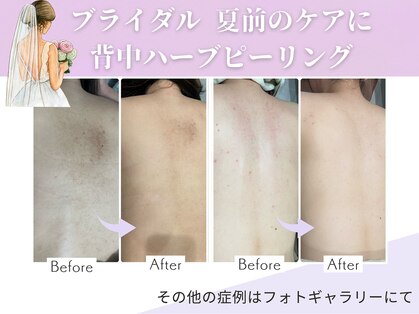 ハービー(Herbee)の写真
