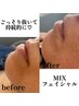 人気【艶玉フェイシャルMIX】パック仕上げ8500円♪パックのおみやげ付き★
