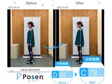 北島坂口鍼灸整骨院/ビフォー、アフター！