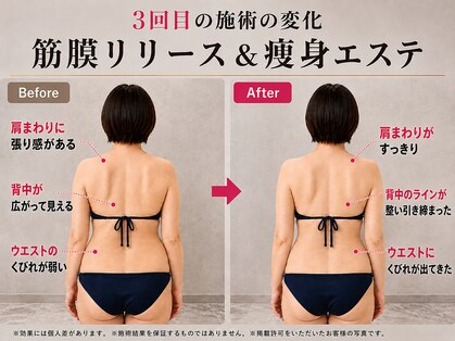 チル 渋谷店(CHILL)の写真