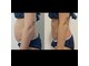 【痩身エステサロン】White Beauty Lab 神戸三ノ宮店【8月11日NEW OPEN(予定)】の写真