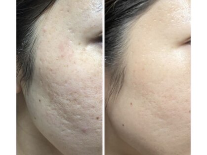 メルシー サロン(Merci Salon)の写真