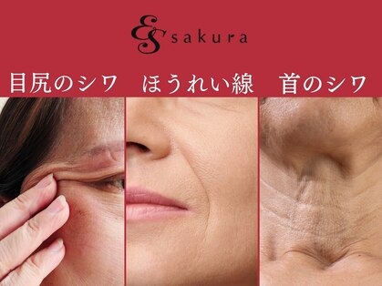 エステサロン さくら ひばりが丘パルコ店の写真
