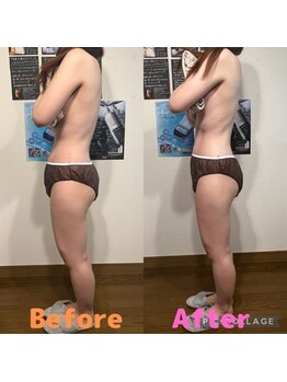 アルメリ 恵比寿(Almeri)/当店人気No.1【全身痩せ】