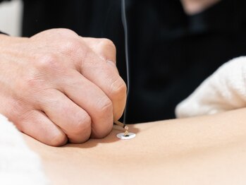 まこと治療院の写真/【愛媛/伊予市】《2回目以降もお得に♪》通い続けられる価格帯で本気の改善を◎新規様限定￥5000→￥4300