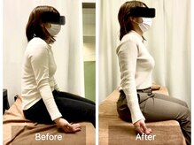 伊藤接骨院の雰囲気（この姿勢の変化をぜひご体感ください◎【肩こり/腰痛/猫背矯正】）