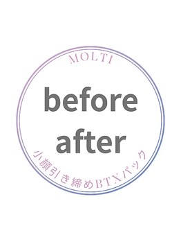 モルティー 宇都宮本店(Molti)/before→after