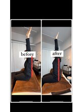 クラーレ(CURARE)/before、after