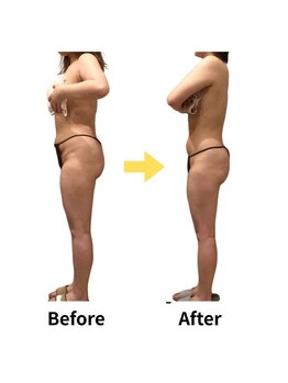 ムーロ(muro.)/BeforeAfter