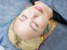 プライブ(PRIVE)の雰囲気(電気美容鍼)