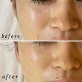 ルマエクレ(rmaecla)