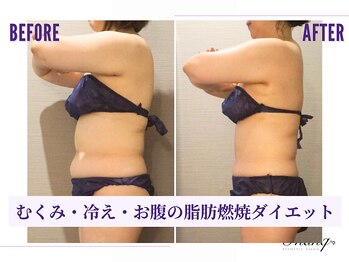 サンク(Thanq)/筋膜リンパマッサージダイエット