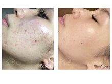 サロン バイオビオ(SALON BioBio)/