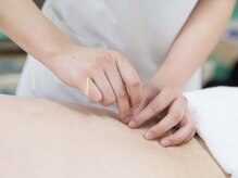 トイトイトイ(toitoitoi)の雰囲気（女性鍼灸師による女性専用プライべートサロン）