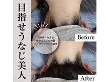 ルウム(lum)/脱毛サロンlum