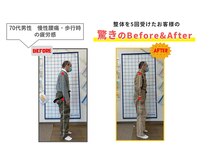 にこにこ整体 整骨院/【腰痛・猫背矯正】整体をBE⇒AF