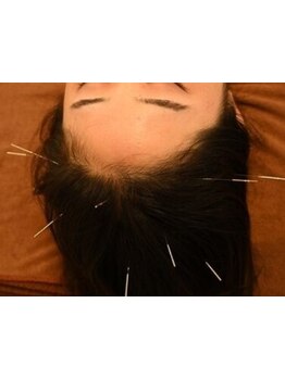 眼精疲労を解消したい