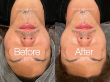 クレヴィア バイ サイバーエステ(CREBIA)/メンズにも【UNSTRESS】