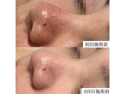 ルポ(RUPO)の写真