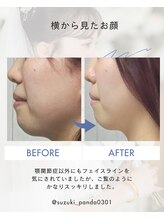 すずき接骨院/顎関節施術｜5週間での変化