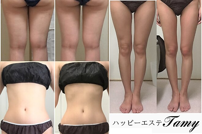 ハッピーエステ タミー(Tamy)｜ホットペッパービューティー