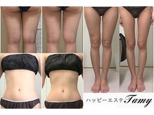 ハッピーエステ タミー(Tamy)