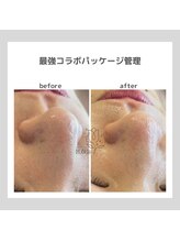 ポムハヌル(pom.haneul)/韓国肌管理室