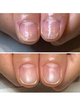 ビビネイル(BIBI Nail)の写真/【美爪育成サロンの本格爪育プランが大人気!!】教育関係・飲食系・お爪にコンプレックスをお持ちの方必見☆