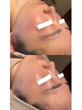 ディオーネ 春日井勝川店(Dione)/マーメイド☆ビフォーアフター