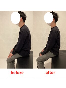 ナオル整体 福岡香椎院(NAORU整体)/20代男性施術事例【猫背】