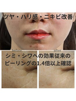 フェリームー(feerie mu)/ララピール