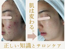 りりあす