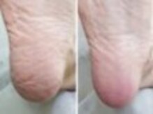 リゼラアンドコー 盛岡店/ドイツ式フットケア専門店