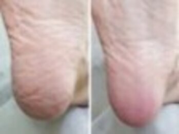 リゼラアンドコー 盛岡店/ドイツ式フットケア専門店