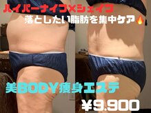 ビーグレイス(Vigrace)