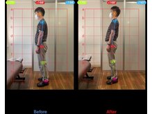 ケアルーム 湘南台(CARE room)/施術効果写真☆（before after）