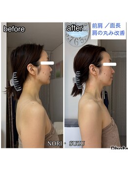 ノリスズ(NORI SUZU)/面長も前肩も猫背も一度で解消！