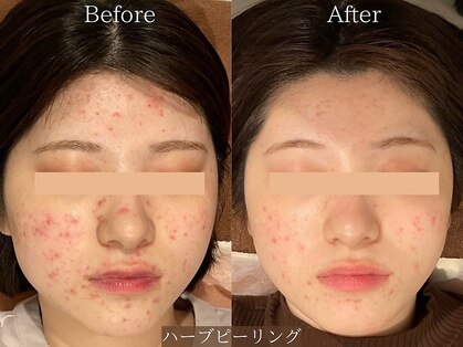 ヒジ(Life Salon)の写真