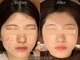 ヒジ(Life Salon)の写真