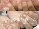 深爪ご相談ください♪