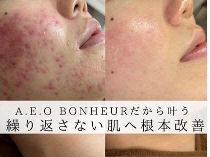 アエオボンヌール(A.E.O BONHEUR)の写真