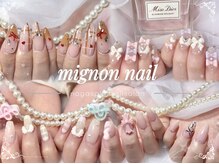 ミニョンネイル(mignon nail)