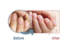 ネイルケアタイム 西葛西店(NAIL CARE TiME)/Before/After