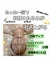 【エイジング美顔小顔】EMS× ヒト幹50％＆エクソソーム導入60分 半額¥10000