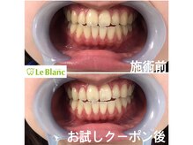 ルブラン 奈良店(Le Blanc)/自己投資しませんか？？