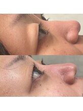 モモ(Momo.)/まつげパーマuロッド使用