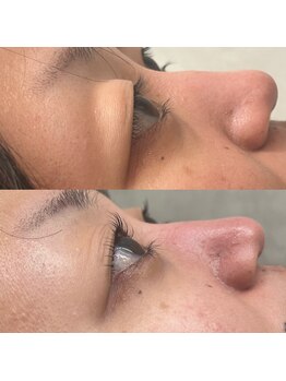 モモ(Momo.)/まつげパーマuロッド使用